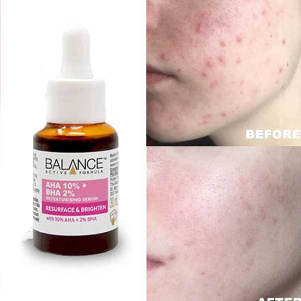 سرم بازسازی و روشن کننده بالانس 30 میل اصل ا Balance AHA 10% + BHA 2% retexturising serum resurface