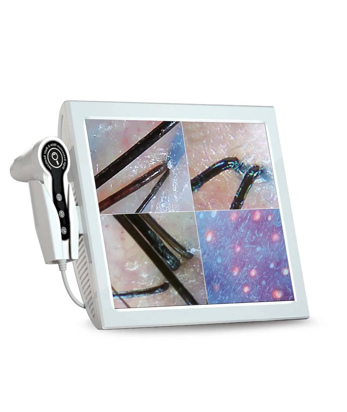 دستگاه آنالیز مو و کف سر 15 اینچ لیز - Lizze Hair and Scalp Analyzer 15 Inch