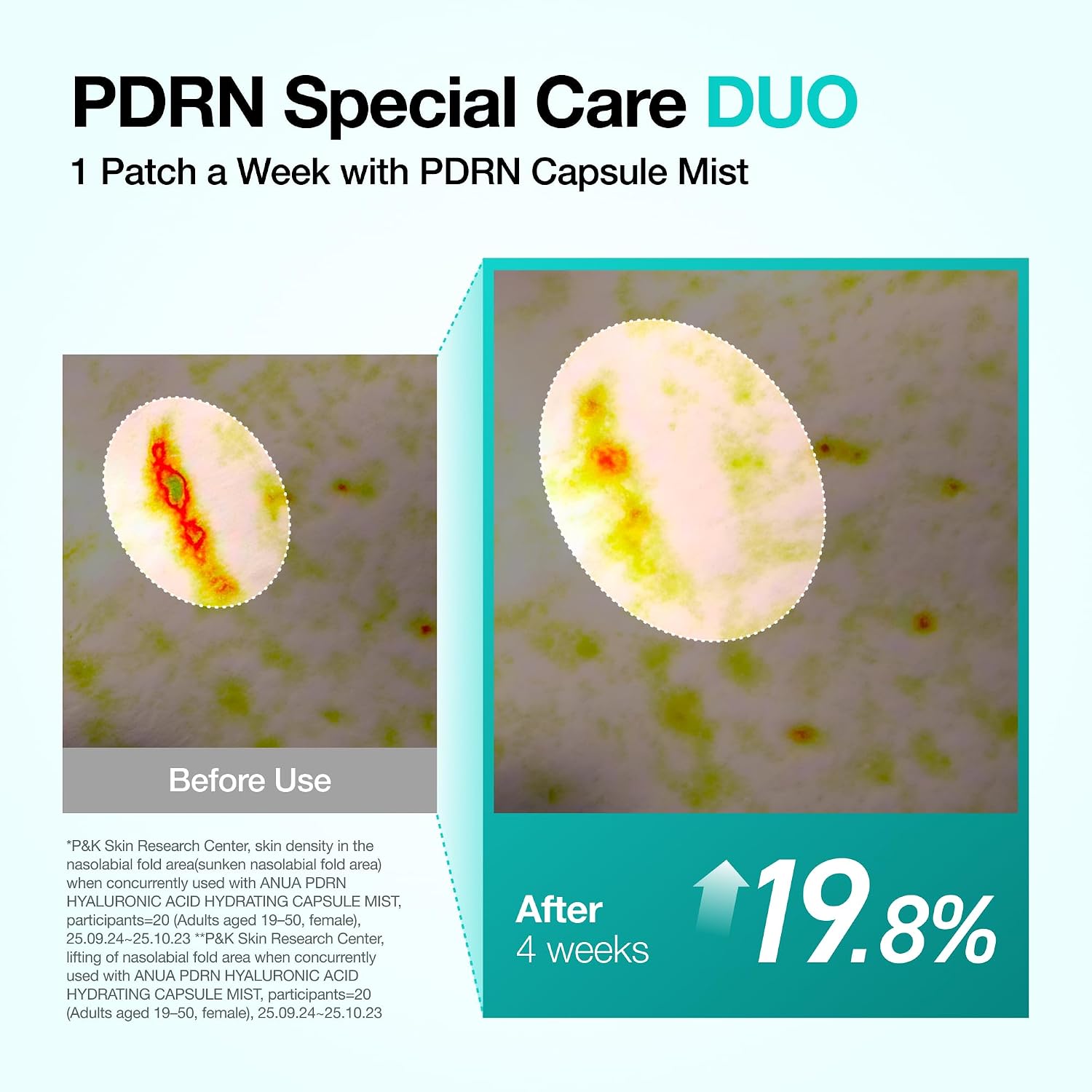 پچ صورت ذوب‌شونده کلاژن PDRN آنوابسته 4 عددی